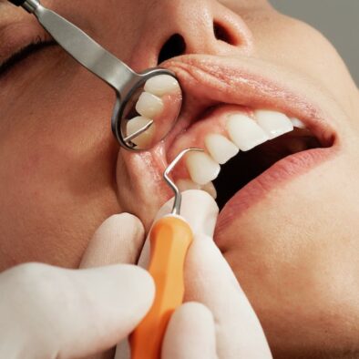 Malattie degenerative del cavo orale: il ruolo della prevenzione.
